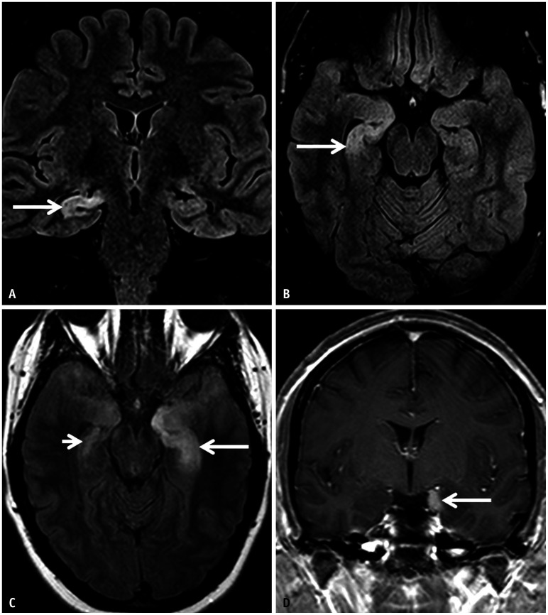 Fig. 17