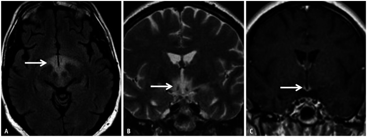 Fig. 16