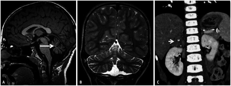 Fig. 19