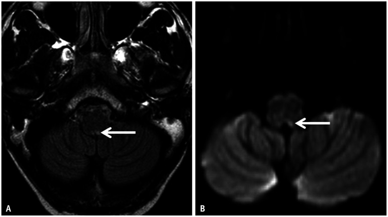 Fig. 12