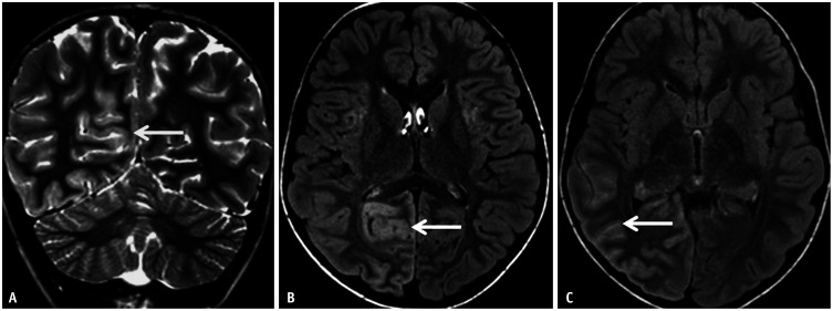 Fig. 14