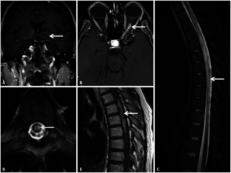 Fig. 11