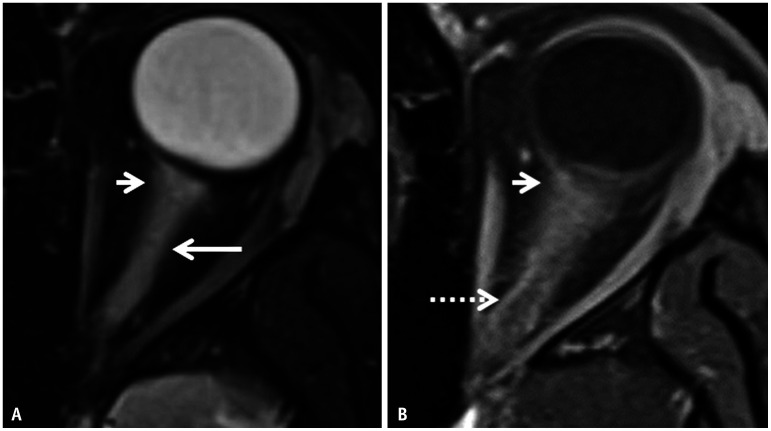 Fig. 15