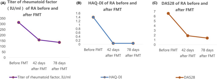 Figure 1 A