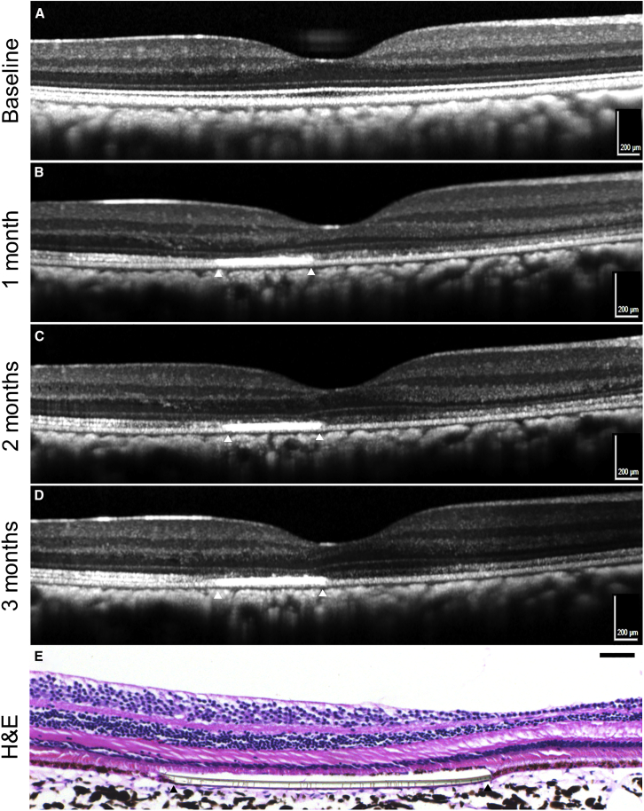 Figure 3