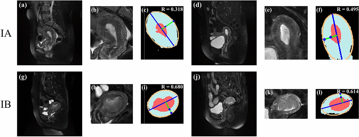 Fig. 4