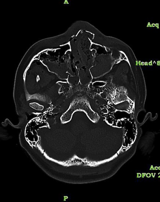 Fig. 4