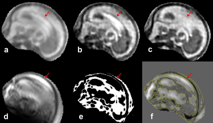 Fig. 8