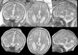 Fig. 11