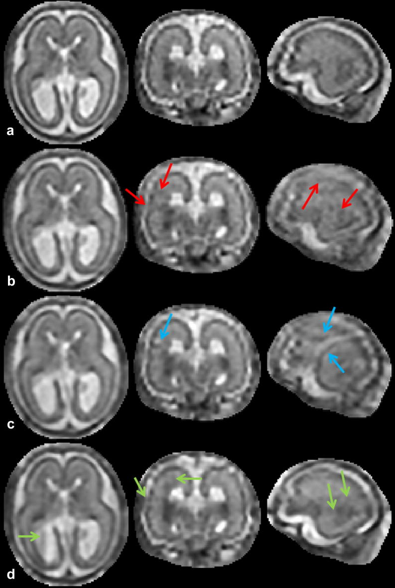 Fig. 12