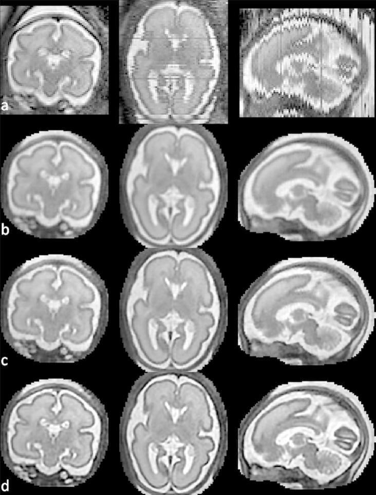 Fig. 13