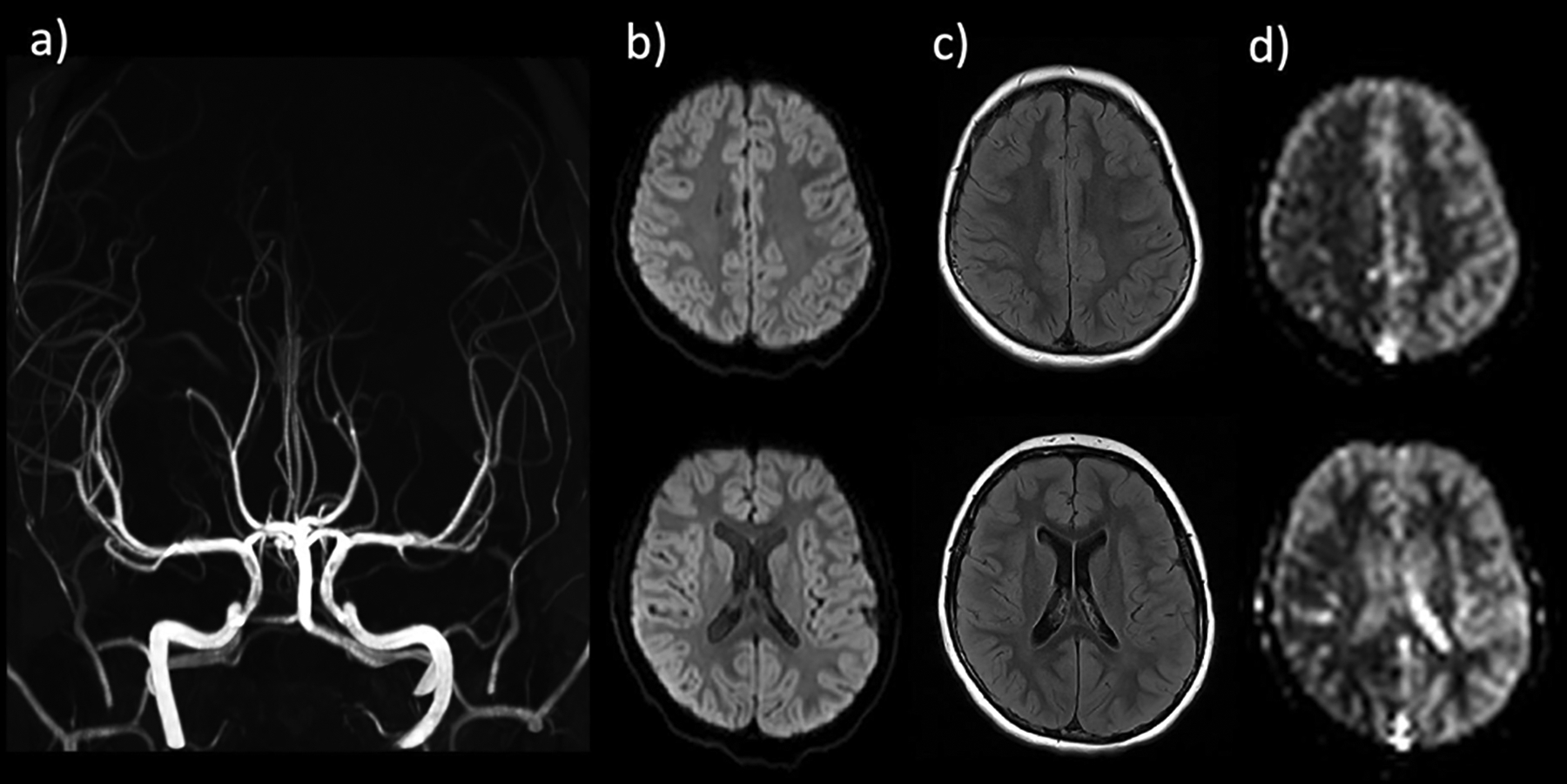 Figure 11.