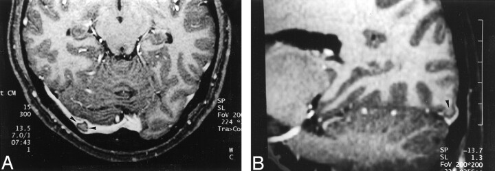 Fig 5.