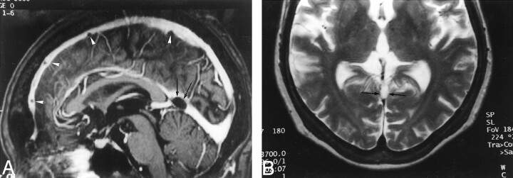 Fig 3.