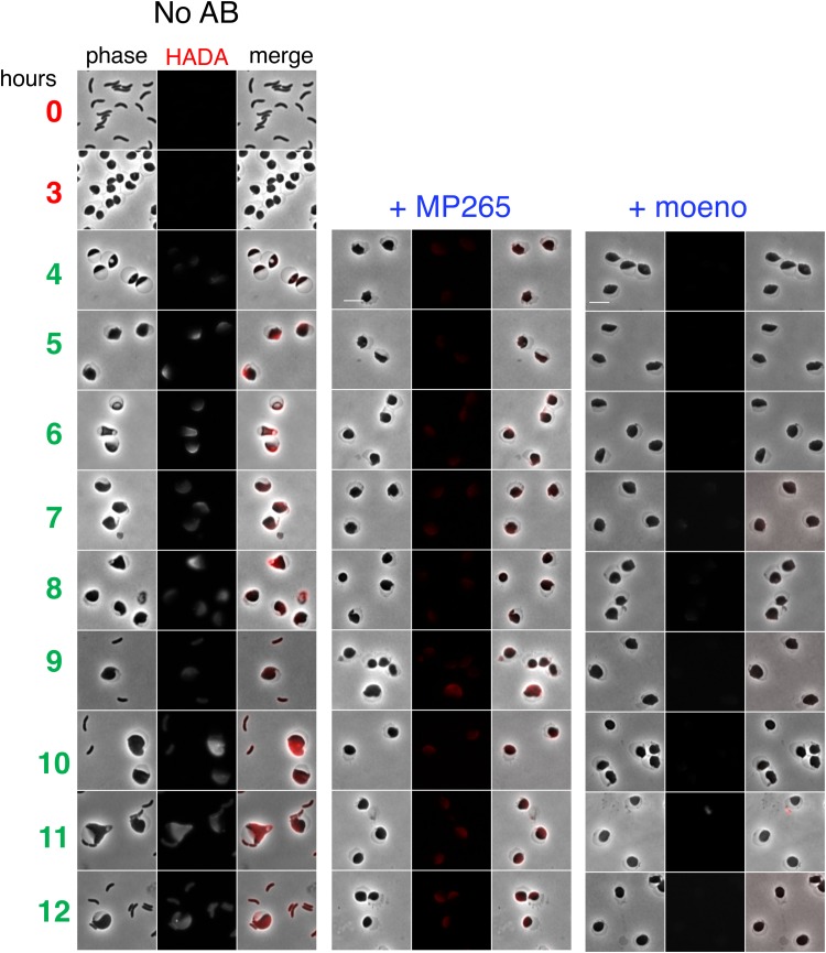 FIG 4