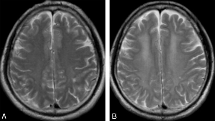 Fig 2.