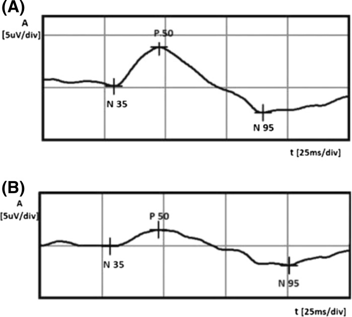 Fig. 4