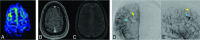 FIG 1.