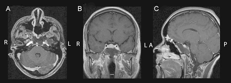 Fig. 5