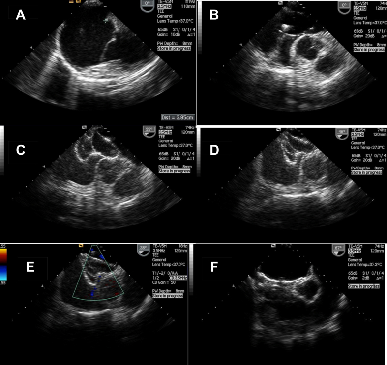 Fig. 2