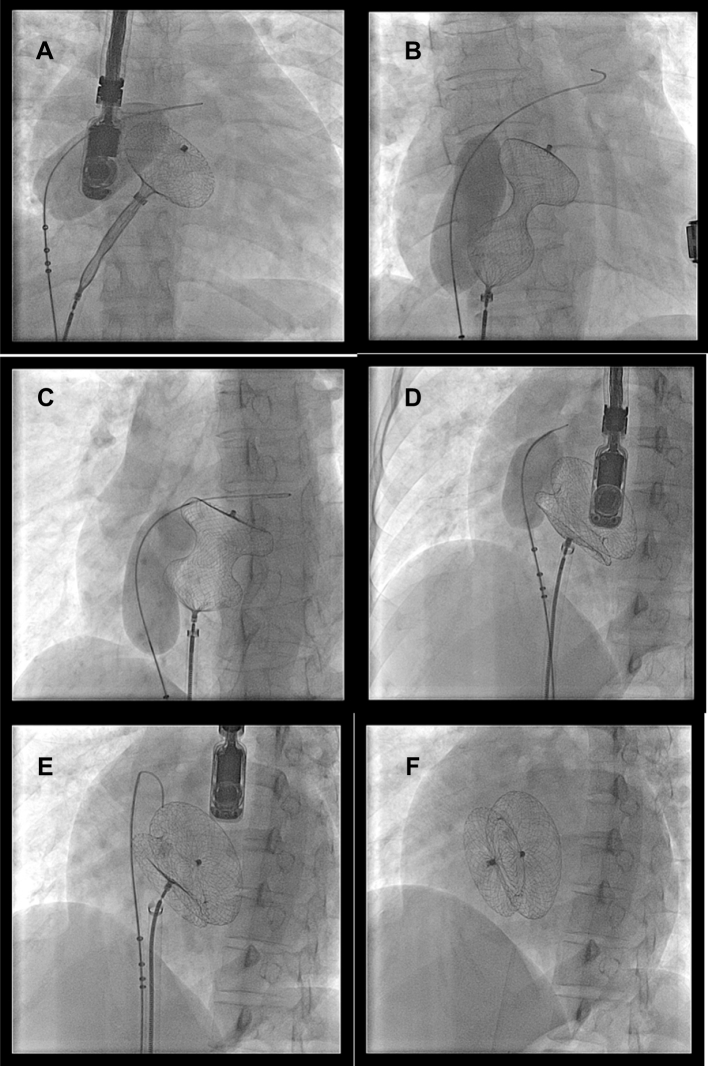 Fig. 3