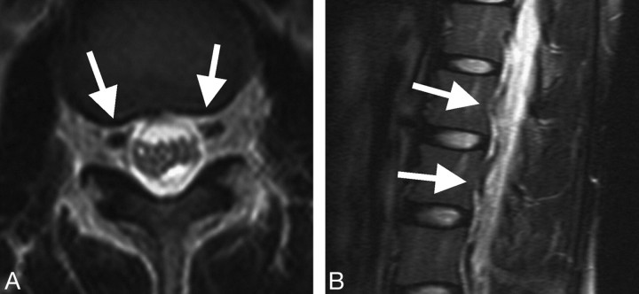 Fig 2.