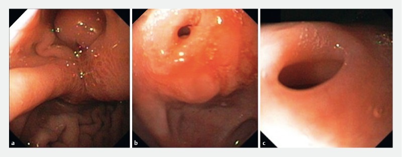 Fig. 2 a