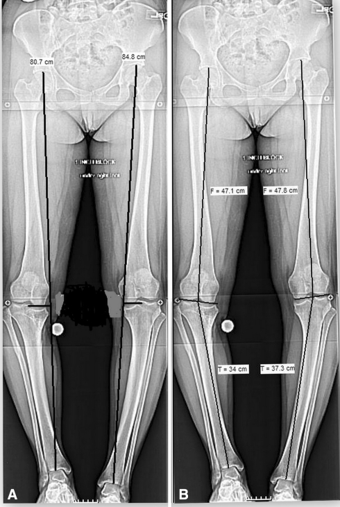 Fig. 3A–B