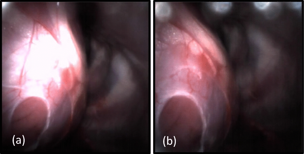 Fig. 4