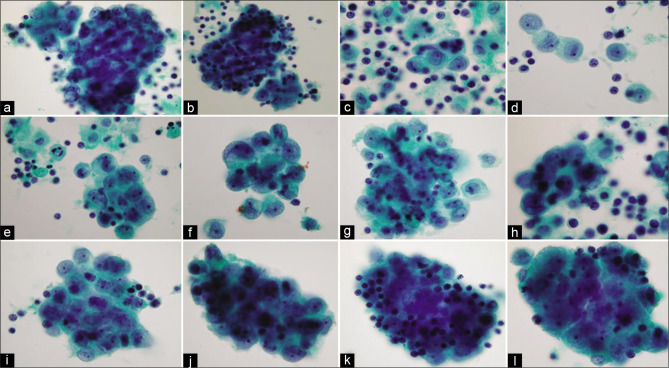 Figure 11: