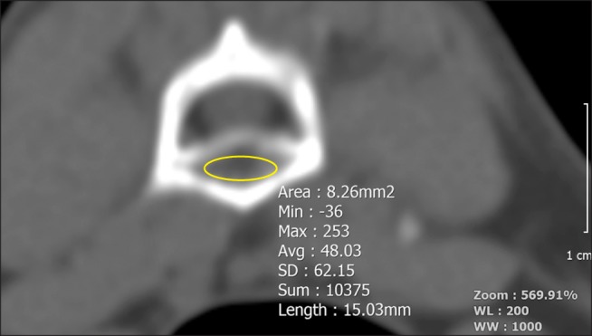 Fig. 3