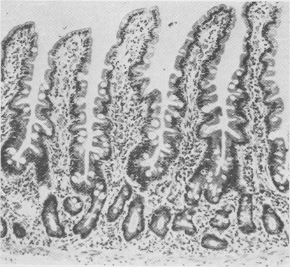 Fig. 2b