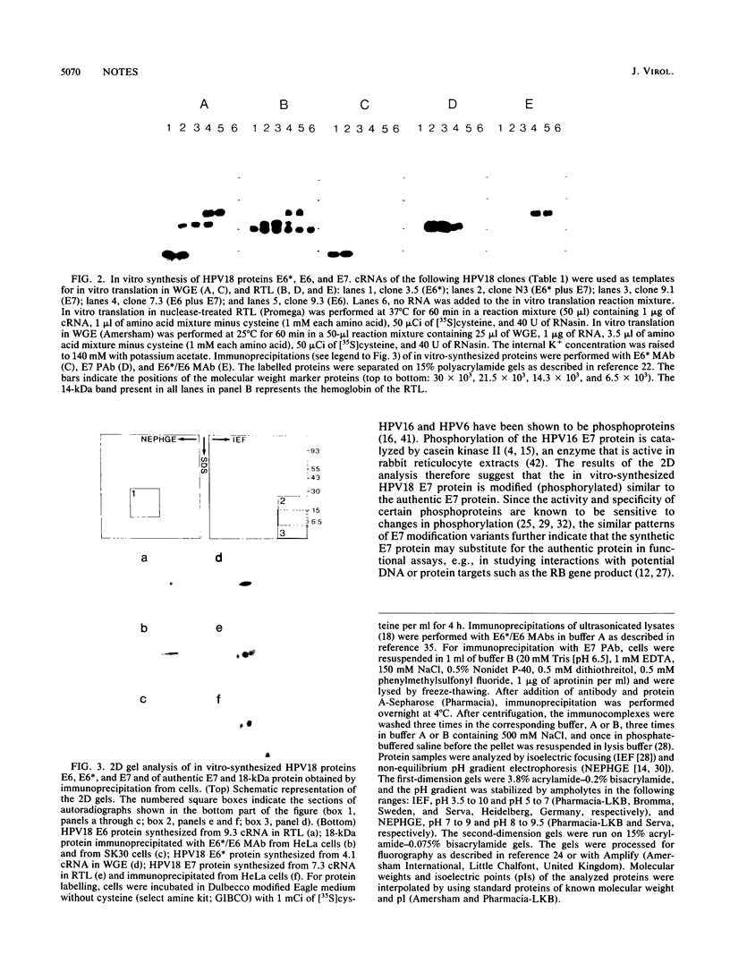 Human papillomavirus type 18 E6*, E6, and E7 protein synthesis in cell ...