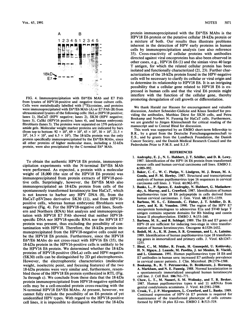 Human papillomavirus type 18 E6*, E6, and E7 protein synthesis in cell ...