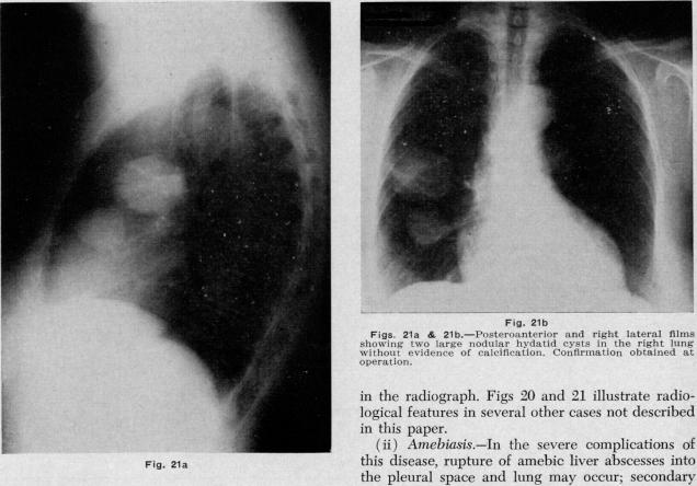 Figs. 21a & 21b