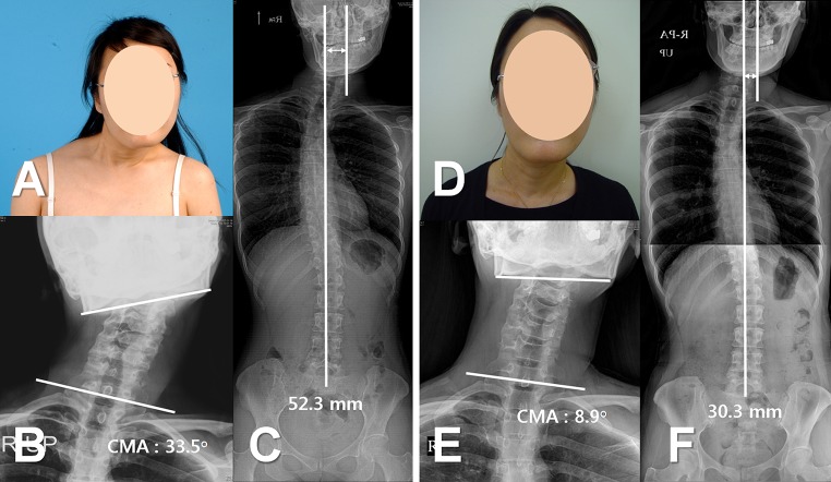 Fig. 4A–F