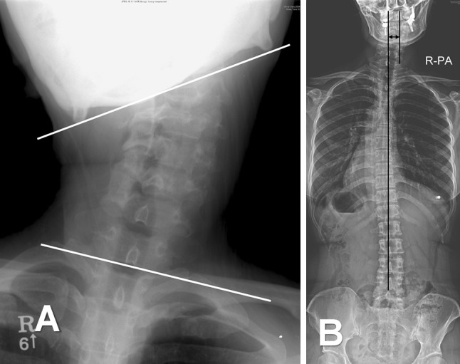 Fig. 2A–B