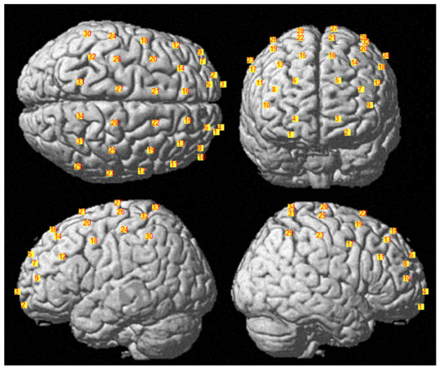 Figure 2