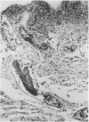 215