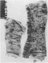 213