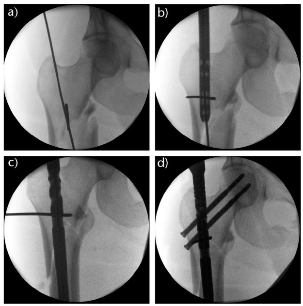 Fig. 5