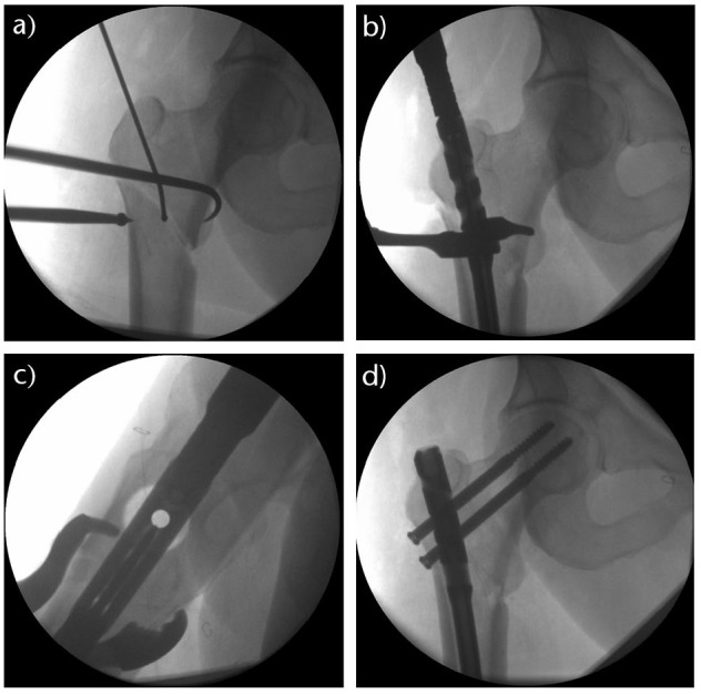 Fig. 3