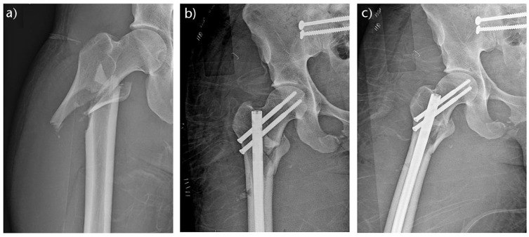 Fig. 2