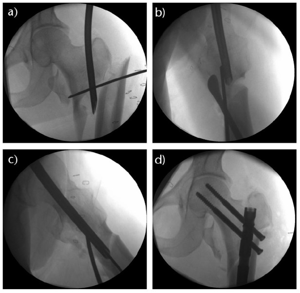 Fig. 4