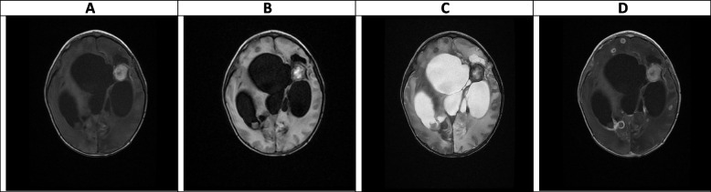 Fig. 11