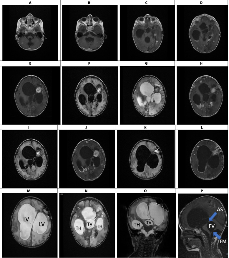 Fig. 10