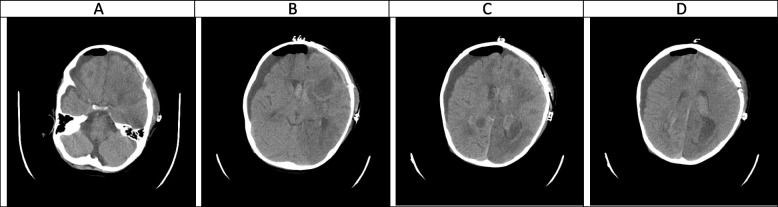Fig. 5