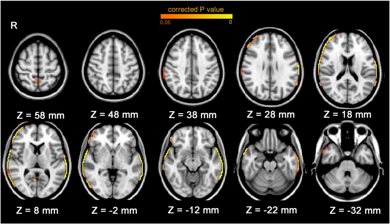 Fig. 1