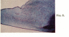 294-1