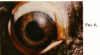294-1